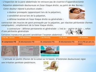 - L’inspection de la paroi abdominale ne retrouve pas de cicatrice d’appendicectomie
- Palpation abdominale douloureuse en fosse iliaque droite, au point de Mac Burney :
Cette douleur répond à plusieurs stades :
o douleur provoquée (apparaissant lors de la palpation),
o sensibilité accrue lors de la palpation,
o défense localisée en fosse iliaque droite ou généralisée :
contraction des muscles de paroi provoquée par la palpation, par réaction péritonéale (formes
compliquées) ; empâtement de la fosse iliaque droite,
o contracture : défense permanente et généralisée : c’est le « ventre de bois », reflet
d’une péritonite généralisée
Certaines manœuvres peuvent sensibiliser l’examen abdominal :
- L’attitude en psoïtis (flexion de la cuisse sur le bassin, d’extension douloureuse) signe
une irritation pariétale postérieure.
S de Mac burney S de Bloomberg S de Rowsing S de Jacob S de Drachter
Dl compression FID Dl décompression FID DL compression FIG Dl décompression FIG dl à la FID par perc du
talent
 