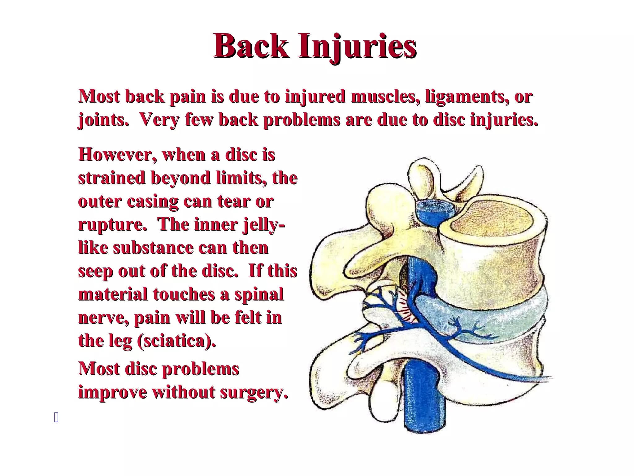 Back InjuriesBack Injuries
Most back pain is due to injured muscles, ligaments, orMost back pain is due to injured muscles, ligaments, or
joints. Very few back problems are due to disc injuries.joints. Very few back problems are due to disc injuries.
However, when a disc isHowever, when a disc is
strained beyond limits, thestrained beyond limits, the
outer casing can tear orouter casing can tear or
rupture. The inner jelly-rupture. The inner jelly-
like substance can thenlike substance can then
seep out of the disc. If thisseep out of the disc. If this
material touches a spinalmaterial touches a spinal
nerve, pain will be felt innerve, pain will be felt in
the leg (sciatica).the leg (sciatica).
Most disc problemsMost disc problems
improve without surgery.improve without surgery.

 