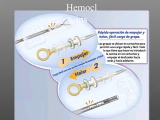 Hemocl
ips
 