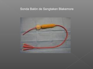 Sonda Balón de Sengtaken Blakemore
 