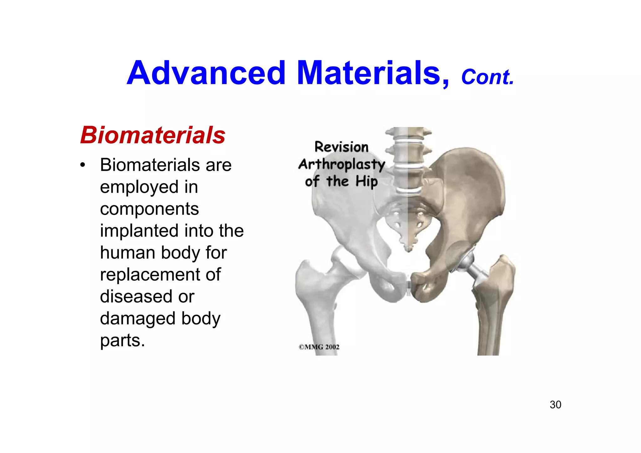 Advanced Materials, Cont.
Biomaterials
• Biomaterials are
employed in
components
implanted into the
human body for
replacement of
diseased or
damaged body
parts.
30
 