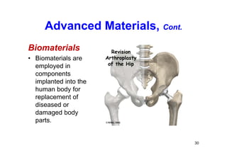 Advanced Materials, Cont.
Biomaterials
• Biomaterials are
employed in
components
implanted into the
human body for
replacement of
diseased or
damaged body
parts.
30
 