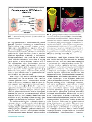 3Инъекционные технологии
во и поэтому называется индифферентной стадией
(рис. 2). Изменения происходят на восьмой неделе
беременности, когда мужской эмбрион начинает
производить свои собственные гормоны. Только тог-
да физическое развитие мужских и женских эмбри-
онов начинает отличаться, хотя меньше чем многие
предполагают. Предстательная железа у женщин,
равно как и у мужчин, развивается из выпячиваний
стенки мочеполового синуса. При том, что развитие
ткани простаты зависит от андрогенов, эстрогены
также влияют на ее физиологию и патологию [12].
Так, наблюдаемая после формирования женских
гонад супрессия андрогенов приводит к снижению
интенсивности роста простаты, однако не вызывает
полной остановки ее последующего развития [13].
Результаты исследования позволяют понять, почему
женская простата не исчезает во время эмбриональ-
ного развития, как считалось ранее.
Женская простата состоит из периуретральных же-
лез, железы Скина, фасции Гальбанса – все эти обра-
зования соединяются через выделительные каналы
в уретре. В то время как мужская предстательная же-
леза окружает уретру, женская простата распределя-
ется по стенке уретры (рис. 3) [14]. Это – главное ма-
кроскопическое различие между мужской и женской
предстательной железой. Толщина стенки и длина
женской уретры ограничивают область формирова-
ния женской простаты, поэтому ее размеры меньше
мужской. Женская простата имеет те же структурные
особенности, что и мужская: железы, протоки и глад-
кая мускулатура (мышечно-фиброзная ткань) [15].
Система выводных протоков сформирована из сети
канальцев разного калибра, их количество превыша-
ет количество функционально активных желез и коли-
чество выводных протоков в мужской простате. Глад-
кая мускулатура также более представлена в женской
простате. Ранее считалось, что секрет женской пред-
стательной железы в виде женского эякулята экскре-
тируется через совместные с железами Скина выво-
дные протоки, но позже было доказано, что женский
эякулят поступает непосредственно в уретру на всем
ее протяжении через парауретральные протоки [16].
Протоки женской простаты выстланы плоским
многорядным эпителием, железы альвеолярного или
трубчато-альвеолярного типа могут группировать-
ся в крупные конгломераты. Железа сформирована
главным образом столбчатыми, кубическими или
умеренно высокими цилиндрическими эпителиаль-
ными клетками. Экзокринная функция женской про-
статы осуществляется за счет наличия особой струк-
туры, включающей секреторные и базальные клетки.
Высокие цилиндрические секреторные (люминаль-
ные) клетки преобладают и в женской, и в мужской
предстательной железе. Апикальная зона цито-
плазмы таких клеток содержит много секреторных
элементов (вакуолей и гранул), шероховатый эндо-
плазматический ретикулюм, развитые комплексы
Гольджи и многочисленные митохондрии. Эти орга-
неллы характеризуют активную секреторную функ-
цию апокринового (апикальные пузырьки жидкости)
и мерокринового (секреторные вакуоли и гранулы)
типов. Базальные (резервные) клетки расположены
между секреторными клетками и базальной мем-
браной. Их цитоплазма богата шероховатым эндо-
плазматическим ретикулюмом и митохондриями,
без секреторных элементов. Ядра, в отличие от ядер
секреторных клеток, содержат большое количество
периферического конденсированного хроматина,
Рис. 2. Эмбриональное развитие мужских и женских
половых органов
Рис. 3. Трехмерная реконструкция взрослой жен-
ской простаты в продольном (а) и поперечном (б)
положениях: предстательная уретра (желтая),
протоки простаты и альвеолы (красные), двойная
стрелка показывает ориентацию железы относи-
тельно передней (A) и задней (P) уретры; протоки,
впадающие в уретру, отмечены стрелкой; на ги-
стологическом срезе женской простаты показана
ориентация протоков (d) и предстательных альве-
ол (g) относительно предстательной уретры (u)
(в) (срез = 25 мкм (а); 20 мкм (б)) [15]
а
б
в
 