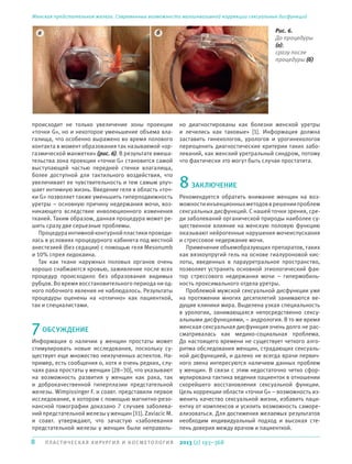 8 П ЛА С Т И ЧЕ СКАЯ ХИРУРГИЯ И КОСМЕТОЛОГИЯ
Женская предстательная железа. Современные возможности малоинвазивной коррекции сексуальных дисфункций
2013 (2) 193–368
происходит не только увеличение зоны проекции
«точки G», но и некоторое уменьшение объема вла-
галища, что особенно выражено во время полового
контакта в момент образования так называемой «ор-
газмической манжетки» (рис. 6). В результате вмеша-
тельства зона проекции «точки G» становится самой
выступающей частью передней стенки влагалища,
более доступной для тактильного воздействия, что
увеличивает ее чувствительность и тем самым улуч-
шает интимную жизнь. Введение геля в область «точ-
ки G» позволяет также уменьшить гиперподвижность
уретры – основную причину недержания мочи, воз-
никающего вследствие инволюционного изменения
тканей. Таким образом, данная процедура может ре-
шить сразу две серьезные проблемы.
Процедураинтимнойконтурнойпластикипроводи-
лась в условиях процедурного кабинета под местной
анестезией (без седации) с помощью геля Mesonumb
и 10% спрея лидокаина.
Так как ткани наружных половых органов очень
хорошо снабжаются кровью, заживление после всех
процедур происходило без образования видимых
рубцов. Во время восстановительного периода ни од-
ного побочного явления не наблюдалось. Результаты
процедуры оценены на «отлично» как пациенткой,
так и специалистами.
7ОБСУЖДЕНИЕ
Информация о наличии у женщин простаты может
стимулировать новые исследования, поскольку су-
ществует еще множество неизученных аспектов. На-
пример, есть сообщения о, хотя и очень редких, слу-
чаях рака простаты у женщин [28–30], что указывают
на возможность развития у женщин как рака, так
и доброкачественной гиперплазии предстательной
железы. Wimpissinger F. и соавт. представили первое
исследование, в котором с помощью магнитно-резо-
нансной томографии доказано 7 случаев заболева-
ний предстательной железы у женщин [31]. Zaviacic M.
и соавт. утверждают, что зачастую «заболевания
предстательной железы у женщин были неправиль-
но диагностированы как болезни женской уретры
и лечились как таковые» [1]. Информация должна
заставить гинекологов, урологов и урогинекологов
переоценить диагностические критерии таких забо-
леваний, как женский уретральный синдром, потому
что фактически это могут быть случаи простатита.
8ЗАКЛЮЧЕНИЕ
Рекомендуется обратить внимание женщин на воз-
можностиинъекционныхметодовврешениипроблем
сексуальных дисфункций. С нашей точки зрения, сре-
ди заболеваний органической природы наиболее су-
щественное влияние на женскую половую функцию
оказывают нейрогенные нарушения мочеиспускания
и стрессовое недержание мочи.
Применение объемобразующих препаратов, таких
как вязкоупругий гель на основе гиалуроновой кис-
лоты, введенных в парауретральное пространство,
позволяет устранить основной этиологический фак-
тор стрессового недержания мочи – гипермобиль-
ность проксимального отдела уретры.
Проблемой мужской сексуальной дисфункции уже
на протяжении многих десятилетий занимаются ве-
дущие клиники мира. Выделена узкая специальность
в урологии, занимающаяся непосредственно сексу-
альными дисфункциями, – андрология. В то же время
женская сексуальная дисфункция очень долго не рас-
сматривалась как медико-социальная проблема.
До настоящего времени не существует четкого алго-
ритма обследования женщин, страдающих сексуаль-
ной дисфункцией, и далеко не всегда врачи первич-
ного звена интересуются наличием данных проблем
у женщин. В связи с этим недостаточно четко сфор-
мулирована тактика ведения пациенток в отношении
скорейшего восстановления сексуальной функции.
Цель коррекции области «точки G» – возможность из-
менить качество сексуальной жизни, избавить паци-
ентку от комплексов и усилить возможность саморе-
ализоваться. Для достижения желаемых результатов
необходим индивидуальный подход и высокая сте-
пень доверия между врачом и пациенткой.
Рис. 6.
До процедуры
(а);
сразу после
процедуры (б)
а б
 