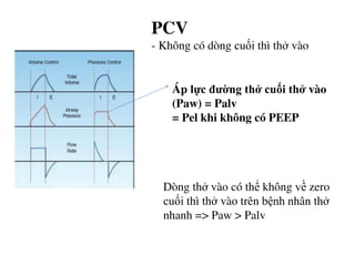 Zero Pcv Đại cường về thông khí nhân tạo _ thở máy | PDF