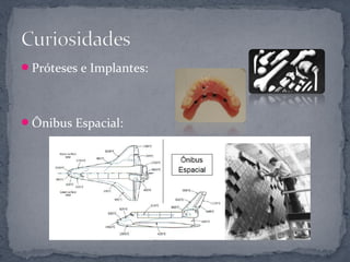 Próteses e Implantes:




Ônibus Espacial:
 