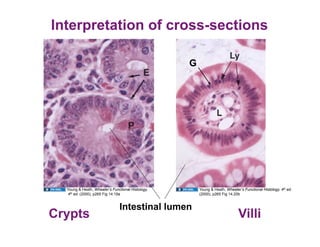 Interpretation of cross-sections

                                                   G




  Young & Heath, Wheater’s Functional Histology,       Young & Heath, Wheater’s Functional Histology, 4th ed.
  4th ed. (2000), p265 Fig 14.19a                      (2000), p265 Fig 14.20b


                               Intestinal lumen
Crypts                                                                       Villi
 