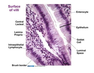 Surface
 of villi                               Enterocyte



      Central
      Lacteal
                                        Epithelium
     Lamina
     Propria

                                        Goblet
                                        Cell
Intraepithelial
Lymphocyte
                                        Luminal
                                        Space




   Brush border   Source Undetermined
 