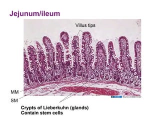 Jejunum/ileum
                            Villus tips




MM
                                          Source Undetermined

SM
     Crypts of Lieberkuhn (glands)
     Contain stem cells
 