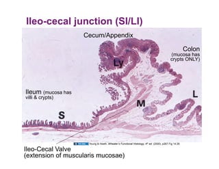 Ileo-cecal junction (SI/LI)
                    Cecum/Appendix

                                                                                                     Colon
                                                                                          (mucosa has
                                                                                          crypts ONLY)




Ileum (mucosa has
villi & crypts)




                     Young & Heath, Wheater’s Functional Histology, 4th ed. (2000), p267 Fig 14.26

Ileo-Cecal Valve
(extension of muscularis mucosae)
 