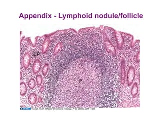 Appendix - Lymphoid nodule/follicle




   Young & Heath, Wheater’s Functional Histology, 4th ed. (2000), p271.14.29b
 