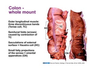Colon -
whole mount

Outer longitudinal muscle:
three discontinuous bands
(Teniae coli, TC)

Semilunal folds (arrows)
caused by contraction of
TC

Sacculations of external
surface = Haustra coli (HC)

Small fatty projections
of the serosa = omental
appendices (OA)

                              Ross and Pawlina, Histology: A Text and Atlas, 5th ed. (2006), p548.
 