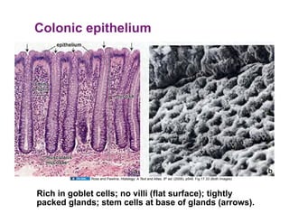 Colonic epithelium




             Ross and Pawlina, Histology: A Text and Atlas, 5th ed. (2006), p548. Fig 17.33 (Both Images)



Rich in goblet cells; no villi (flat surface); tightly
packed glands; stem cells at base of glands (arrows).
 