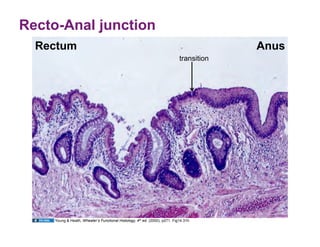 Recto-Anal junction
  Rectum                                                                                  Anus
                                                                             transition




     Young & Heath, Wheater’s Functional Histology, 4th ed. (2000), p271. Fig14.31h
 