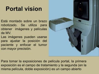 Portal vision 
Está montado sobre un brazo 
robotizado. Se utiliza para 
obtener imágenes y películas 
de MV. 
Las imágenes pueden usarse 
para ajustar la posición del 
paciente y enfocar el tumor 
con mayor precisión. 
Para tomar la exposiciones de película portal, la primera 
exposición es el campo de tratamiento y la segunda (en la 
misma película, doble exposición) es un campo abierto 
 