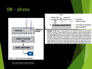 DR - direto
http://www.analog.com/en/content/digital_x-
ray_technology_improves_patient_exp/fca.html
111
 