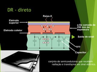 DR - direto
conjnto de semicondutores que recebem
radiação e transforma em sinal elétrico.
Raios-X
TFT
Capacitor
a-Se camada de
250 mm de
espessura
Eletrodo
superior
Eletrodo coletor
Saída de sinal
112
 