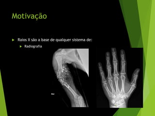Motivação
 Raios X são a base de qualquer sistema de:
 Radiografia
3
 