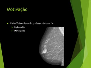 Motivação
 Raios X são a base de qualquer sistema de:
 Radiografia
 Mamografia
4
 