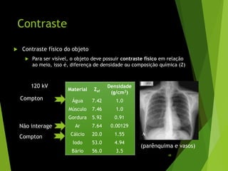 Contraste
 Contraste físico do objeto
 Para ser visível, o objeto deve possuir contraste físico em relação
ao meio, isso é, diferença de densidade ou composição química (Z)
Material Zef
Densidade
(g/cm3)
Água 7.42 1.0
Músculo 7.46 1.0
Gordura 5.92 0.91
Ar 7.64 0.00129
Cálcio 20.0 1.55
Iodo 53.0 4.94
Bário 56.0 3.5
Compton
Compton
Não interage
120 kV
A
(parênquima e vasos)
48
 