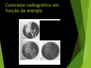 Contraste radiográfico em
função da energia
49
 