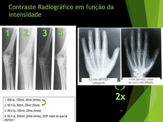 Contraste Radiográfico em função da
intensidade
50
 