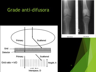 Grade anti-difusora
52
 