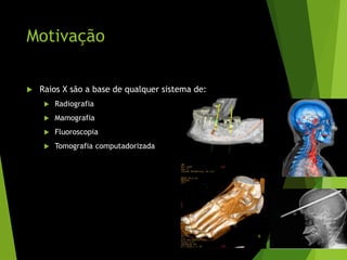 Motivação
 Raios X são a base de qualquer sistema de:
 Radiografia
 Mamografia
 Fluoroscopia
 Tomografia computadorizada
6
 
