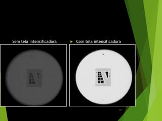 Sem tela intensificadora  Com tela intensificadora
61
 