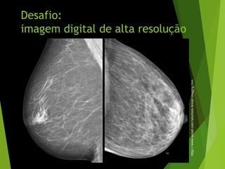 Desafio:
imagem digital de alta resolução
http://www.anrad.com/solutions-breast-imaging.htm
95
 