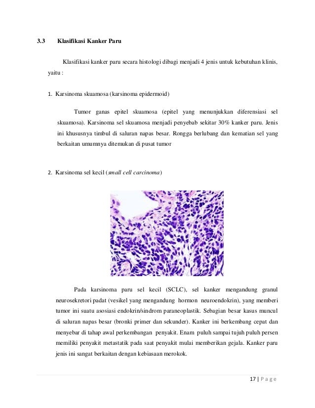 Lung Cancer (kanker Paru paru _ Ilmu.kedokteran)
