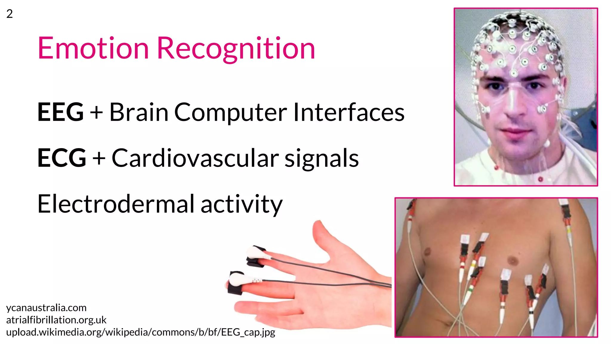 Emotion Recognition
EEG + Brain Computer Interfaces
ECG + Cardiovascular signals
Electrodermal activity
ycanaustralia.com
atrialfibrillation.org.uk
upload.wikimedia.org/wikipedia/commons/b/bf/EEG_cap.jpg
2
 