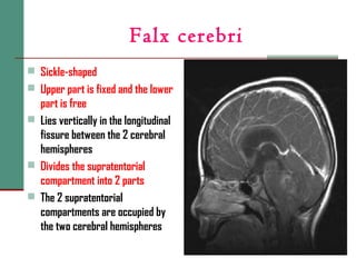 Falx cerebri
 Sickle-shaped
 Upper part is fixed and the lower
part is free
 Lies vertically in the longitudinal
fissure between the 2 cerebral
hemispheres
 Divides the supratentorial
compartment into 2 parts
 The 2 supratentorial
compartments are occupied by
the two cerebral hemispheres
 
