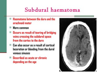Subdural haematoma
 Haematoma between the dura and the
arachnoid mater
 More common
 Occurs as result of tearing of bridging
veins crossing the subdural space
from the cortex to the dura
 Can also occur as a result of cortical
laceration or bleeding from the dural
venous sinuses
 Described as acute or chronic
depending on the age
 