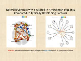 Network Connectivity is Altered in Arrowsmith Students
Compared to Typically Developing Controls
Red lines indicate connections that are stronger, and blue lines weaker, in Arrowsmith students
 