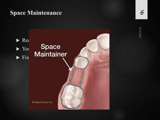 Space Maintenance
 Recent extraction/ trauma
 Young patient
 Fixed prosthesis contraindicated
6
 