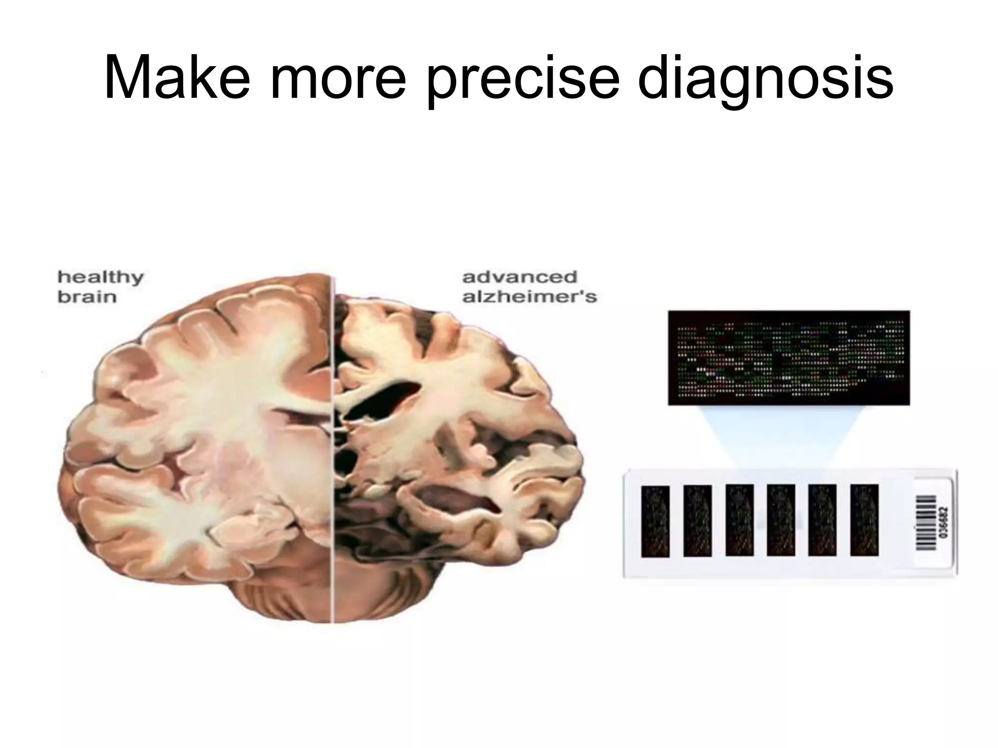 Make more precise diagnosis
 