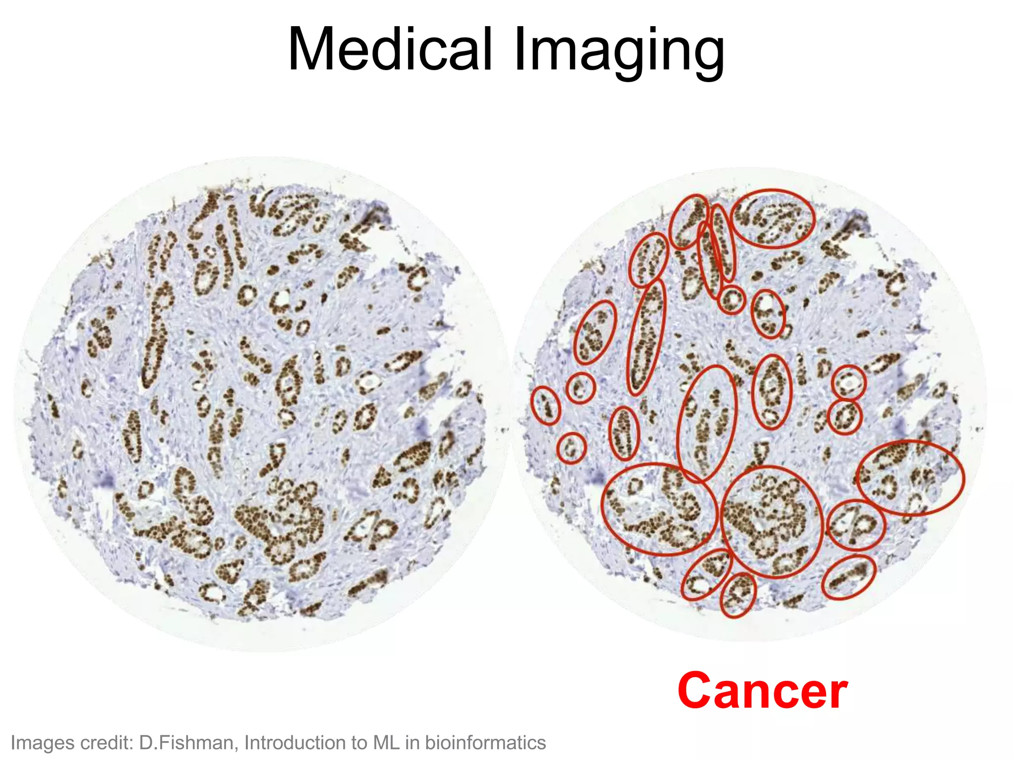 Medical Imaging
Cancer
Images credit: D.Fishman, Introduction to ML in bioinformatics
 