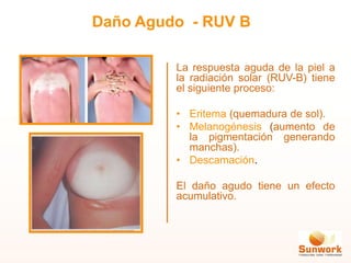La respuesta aguda de la piel a
la radiación solar (RUV-B) tiene
el siguiente proceso:
• Eritema (quemadura de sol).
• Melanogénesis (aumento de
la pigmentación generando
manchas).
• Descamación.
El daño agudo tiene un efecto
acumulativo.
Daño Agudo - RUV B
 