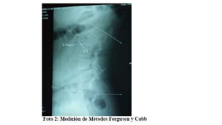 01. RADIOLOGIA LUMBOSACRO DR ORLANDO.pptx