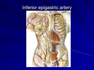 Inferior epigastric artery
 