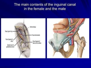 The main contents of the inguinal canal
in the female and the male
 