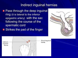 Indirect inguinal hernias
Pass through the deep inguinal
ring (it is lateral to the inferior
epigastric artery) with the sac
following the course of the
spermatic cord
Strikes the pad of the finger
 