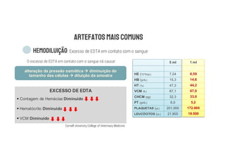 : Excesso de EDTA em contato com o sangue
O excesso de EDTA em contato com o sangue irá causar:
alteração da pressão osmótica diminuição do
tamanho das células diluição da amostra
EXCESSO DE EDTA
§ Contagem de Hemácias Diminuído
§ Hematócrito Diminuído
§ VCM Diminuído
5 ml
HE
HB
HT
VCM
CHCM
PT
PLAQUETAS
LEUCÓCITOS
1 ml
6,59
14,6
44,2
67,0
33,0
5,2
172.000
18.500
Cornell University College of Veterinary Medicine
 
