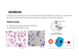 A presença de esferócitos implica na presença de anticorpos ligados a superfície ou componentes
do sistema complemento que são reconhecidos na superfície celular pelos fagócitos
POSSÍVEIS CAUSAS:
§ Indicador sensível de anemia hemolítica
imunomediada (AHIM) em cães
Thrall, 2014
Sanimvet
 