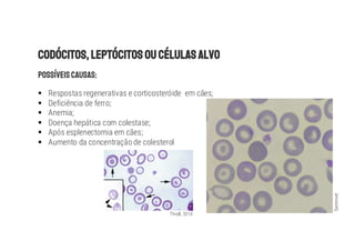 § Respostas regenerativas e corticosteróide em cães;
§ Deficiência de ferro;
§ Anemia;
§ Doença hepática com colestase;
§ Após esplenectomia em cães;
§ Aumento da concentração de colesterol
Thrall, 2014
Sanimvet
 
