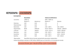 Leucocitose por neutrofilia com toxicidade
 