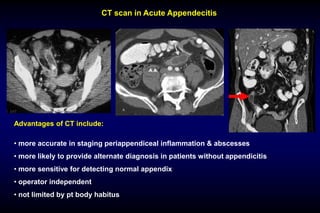 01.Acute appendicitis and chronic appendicitis.pdf