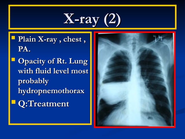X0ray presentation for surgical health care | PPT