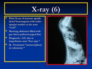 X0ray presentation for surgical health care | PPT